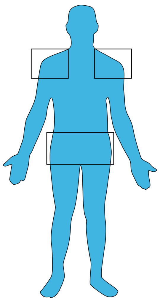 In polmyalgia rheumatica (PMR), pain is usually located in the shoulders and hips.