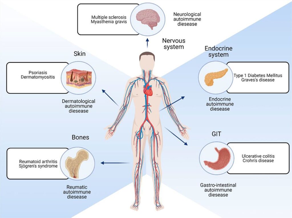 Autoimmune disease diagnosis. Different locations of the body that are affected by autoimmune diseases.